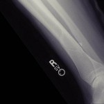 ODB_150214
